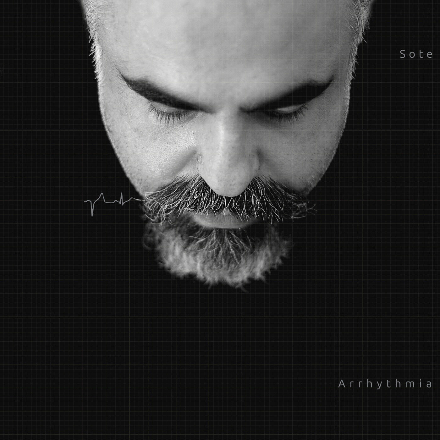Sote – Arrhythmia