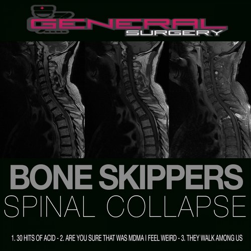Bone Skippers – Spinal Collapse