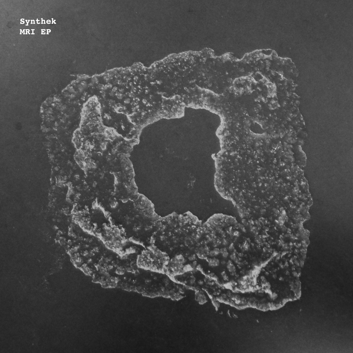 Synthek – MRI EP