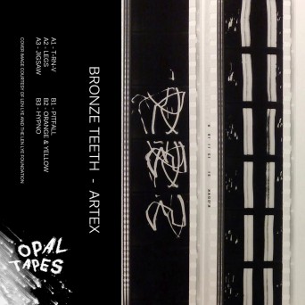 Bronze Teeth – Artex