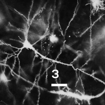 Synapse – Knowing Something 3