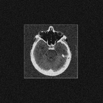 Zobol – Foreign Objects EP